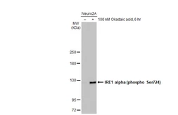 Anti-IRE1 alpha (phospho Ser724) antibody used in Western Blot (WB). GTX132808