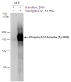Anti-EGFR (phospho Tyr1068) antibody used in Western Blot (WB). GTX132810
