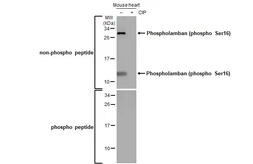 Anti-Phospholamban (phospho Ser16) antibody used in Western Blot (WB). GTX132818
