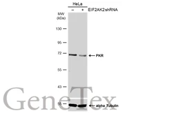 Anti-PKR antibody used in Western Blot (WB). GTX132826