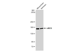 Anti-nNOS antibody used in Western Blot (WB). GTX132857