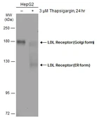 Anti-LDL Receptor antibody used in Western Blot (WB). GTX132860