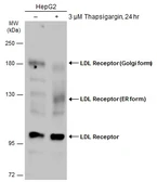 Anti-LDL Receptor antibody used in Western Blot (WB). GTX132861