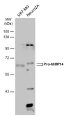 Anti-MMP14 antibody used in Western Blot (WB). GTX132884