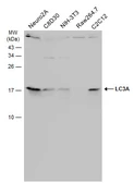 Anti-LC3A antibody used in Western Blot (WB). GTX132889