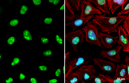 Anti-Nucleolin antibody used in Immunocytochemistry/ Immunofluorescence (ICC/IF). GTX132891