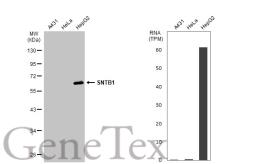 Anti-SNTB1 antibody used in Western Blot (WB). GTX132898