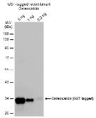 Anti-Osteocalcin antibody used in Western Blot (WB). GTX132902