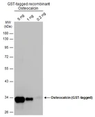 Anti-Osteocalcin antibody used in Western Blot (WB). GTX132902