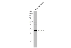 Anti-MPZ antibody used in Western Blot (WB). GTX132911