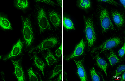 Anti-ATP5B antibody used in Immunocytochemistry/ Immunofluorescence (ICC/IF). GTX132925