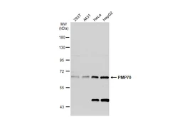 Anti-PMP70 antibody used in Western Blot (WB). GTX132932