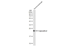 Anti-Lipocalin-2 antibody used in Western Blot (WB). GTX132936