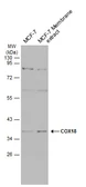 Anti-COX18 antibody used in Western Blot (WB). GTX132940