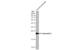 Anti-Lipocalin-2 antibody used in Western Blot (WB). GTX132952