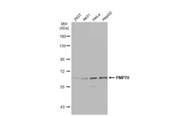 Anti-PMP70 antibody used in Western Blot (WB). GTX132960