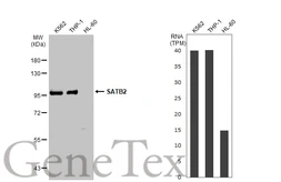 Anti-SATB2 antibody used in Western Blot (WB). GTX132972