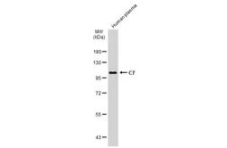 Anti-C7 antibody used in Western Blot (WB). GTX132977