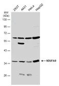 Anti-NDUFA9 antibody used in Western Blot (WB). GTX132978