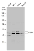 Anti-VASP antibody used in Western Blot (WB). GTX132983