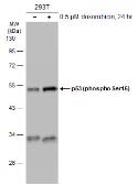 Anti-p53 (phospho Ser46) antibody used in Western Blot (WB). GTX132996
