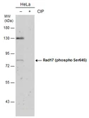 Anti-Rad17 (phospho Ser645) antibody used in Western Blot (WB). GTX133005