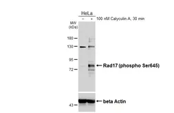 Anti-Rad17 (phospho Ser645) antibody used in Western Blot (WB). GTX133005