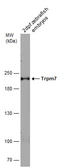 Anti-Trpm7 antibody used in Western Blot (WB). GTX133007