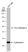 Anti-Cathepsin A antibody used in Western Blot (WB). GTX133016