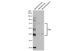 Anti-Tau antibody used in Western Blot (WB). GTX133024