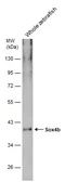 Anti-Sox4b antibody used in Western Blot (WB). GTX133068