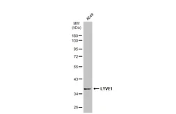 Anti-LYVE1 antibody used in Western Blot (WB). GTX133081