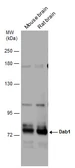 Anti-Dab1 antibody used in Western Blot (WB). GTX133086