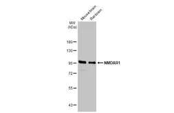 Anti-NMDAR1 antibody used in Western Blot (WB). GTX133097