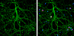 Anti-Nestin antibody used in Immunocytochemistry/ Immunofluorescence (ICC/IF). GTX133111