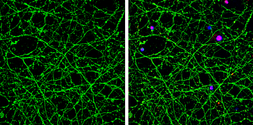 Anti-Nestin antibody used in Immunocytochemistry/ Immunofluorescence (ICC/IF). GTX133112