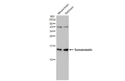 Anti-Somatostatin antibody used in Western Blot (WB). GTX133119