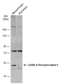 Anti-GABA A Receptor alpha 1 antibody used in Western Blot (WB). GTX133147