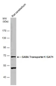 Anti-GABA Transporter 1 / GAT1 antibody used in Western Blot (WB). GTX133150