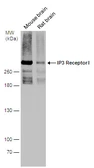 Anti-IP3 Receptor I antibody used in Western Blot (WB). GTX133161
