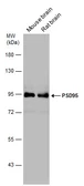 Anti-PSD95 antibody used in Western Blot (WB). GTX133167