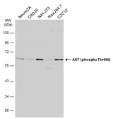 Anti-AKT (phospho Thr450) antibody used in Western Blot (WB). GTX133175