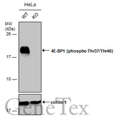 Anti-4E-BP1 (phospho Thr37/Thr46) antibody used in Western Blot (WB). GTX133181