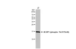 Anti-4E-BP1 (phospho Thr37/Thr46) antibody used in Western Blot (WB). GTX133181
