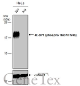 Anti-4E-BP1 (phospho Thr37/Thr46) antibody used in Western Blot (WB). GTX133182