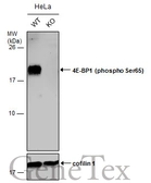 Anti-4E-BP1 (phospho Ser65) antibody used in Western Blot (WB). GTX133184