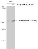 Anti-mTOR (phospho Ser2481) antibody used in Western Blot (WB). GTX133190