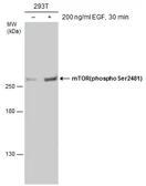 Anti-mTOR (phospho Ser2481) antibody used in Western Blot (WB). GTX133190