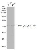 Anti-PTEN (phospho Ser380) antibody used in Western Blot (WB). GTX133192