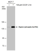 Anti-Raptor (phospho Ser792) antibody used in Western Blot (WB). GTX133196